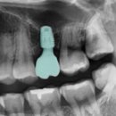 연세김영준치과의원 이미지