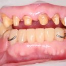 블루치과기공소 이미지