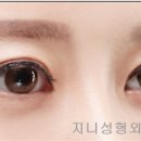 지니성형외과의원 이미지