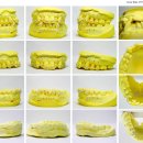 바른치과기공소 이미지