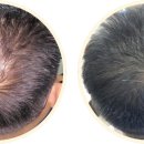 수화헤어 이미지