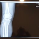 활기찬정형외과의원 이미지