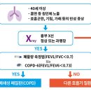 로플루미라스트(Roflumilast)와 아클리디니움/포르메트롤(Aclidinium/formoterol)을 간단히 비교하겠습니다. 이미지