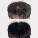 탈모왕 광주점 이미지