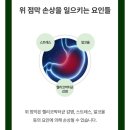 온웰 | 위 영양제 위소겐, 밀가루 먹을 때마다 속 얹히던 제가 한달 먹어본 솔직 후기