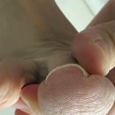 굳은살 | 레푸스 부산덕천점 내성발톱 관리, 굳은살 제거한 내돈내산 후기