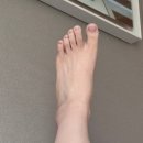 일지한의원 | [회복일지]비수술 전거비인대파열 환자의 7~8주차, 주사치료 후기 (마취통증의학과/체외충격파비추/비용...