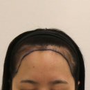 부산 맘모스헤어라인의원 이미지