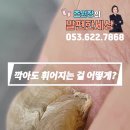 구두착용으로 변형된 발톱 깍아도 휘어지는 걸 어떻게? #문제성발톱 #손에핀꽃 #대구내성발톱 이미지