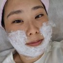 멍크루 | 서면 인모드 후기 내돈내산, 심부볼 리부팅으로 이중턱 라인 정리한 솔직 후기