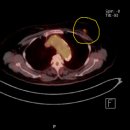 한국건강관리협회 부산센터, 고해상 64CH PET-CT가동 이미지