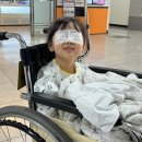 전북대학교병원 | 6세 유아 안검내반 속눈썹찔림 수술 전북대학교병원 후기 (비용, 붓기 경과 등)