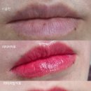 6513 | 대전입술문신탈각후기, 입술문신후기( 캐츠아이)