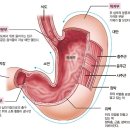 ﻿위 구조 이미지