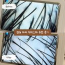 아띠 | 김해 장유 문제성두피관리 추천 아띠 두피스파 후기