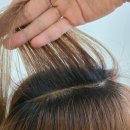 그로우메디 | 천안아산 문제성 두피&amp;헤드스파 케어 탈모가 달라지다