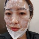 수원 '미드림 성형외과/피부과' 점뺀 리얼 후기