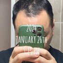 림스내과의원 | 탈모치료 3달 후기_18 Apr 2024