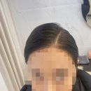 렛미인헤어미용실 | 무료 부평 탈모 두피관리 전문 렛미인x모리바이브 후기