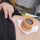 부산대학교병원 | 부산대학교한방병원 한약 첩약 복용 후기/실비보험 처리가능