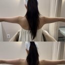 원주 피부관리 원주웨딩관리 팔뚝살엔 미레브 라인업케어 :: 젠에스테틱