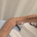 약초사랑성산한의원 | 팔뚝 모공각화증 치료 내돈내산 후기