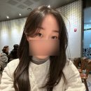 스웨이성형외과의원 | [성형후기] 28살먹고 쌍수한 후기