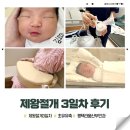 라움어린이집 | 제왕절개 3일차 첫수유 초유유축 페인버스터제거 평택라움산부인과