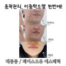 (주)시에로 | 대구 웨딩관리 | 피부속건조, 윤곽관리 잘하는 곳! 봉산동 / 제이스오유 에스테틱 (J'sOU)