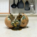 송도탑이비인후과의원 | 송도 편도결석 증상과 편도결석수술: 목 이물감과 지독한 구취로 고생하시고 계신가요?