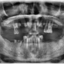 리브원치과의원 이미지