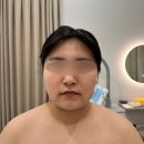 먹도리 | 수원에스테틱 윤곽관리 추천 다리아 온다리프팅 후기