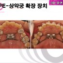 e-플랜트치과 이미지