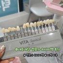 온가족연합치과의원 네이버블로그