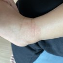키즈드림아이엠씨병원 네이버블로그