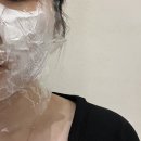 [리뷰] 홍대 주근깨제거 루비레이저 효과,내돈내산 후기, 통증