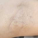 아나덴 슈가링왁싱 수원호매실점 이미지