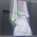 서초성모정형외과의원 이미지