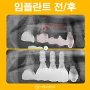서울으뜸치과의원 이미지