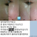 더클라세움화장품 | 더 클라세움 엑소더마 화장품 크림&세럼 후기 / 싸게사는 TIP