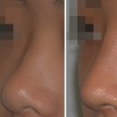 미운오리 이미지