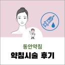 최창열 | 주름 펴는 동안 약침_ 사기라고 오해할 만큼 효과가 있어요