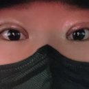 노원 윤앤정 성형외과 쌍꺼풀 부분절개 재수술 후기!