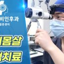 일등이비인후과의원 네이버블로그
