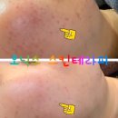 오닉스스킨테라피 | 왕십리피부관리실 &#34;오닉스 스킨테라피&#34; 후기