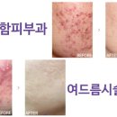 이지함피부과 네이버블로그