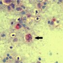 무지개송어의 세포내 감염 Midichloria유사체 감염 Red mark syndrome(RMS) 이미지