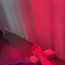 고산이음한의원 | 손목결절종 손목안쪽 멍울 한의원 침치료 후기