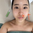 쌍촌동 스킨부스터관리 <비비에스테틱> 속건조 탈출후기🫶🏻