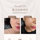 황금피부미인